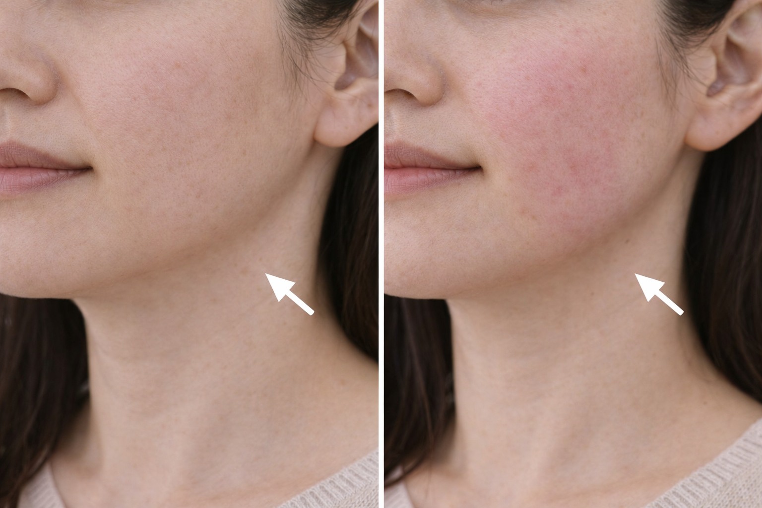 療程對比效果圖